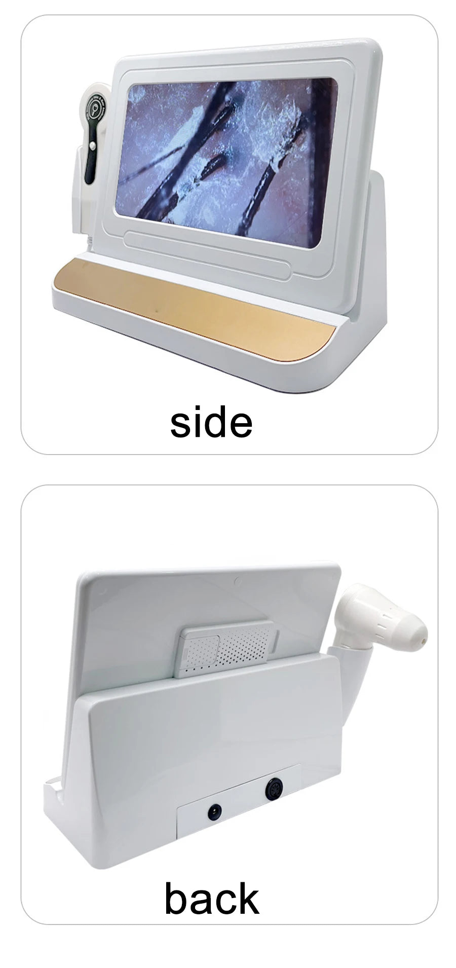 10 Inch LCD Scalp Detector Digital Hair Skin Analyzer Microscope for Hair Follicle Testing and Skin Analysis Magnifier 50/200X